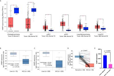 Hepcidin Downregulation Correlates With Disease Aggressiveness And Immune Infiltration in Liver Cancers